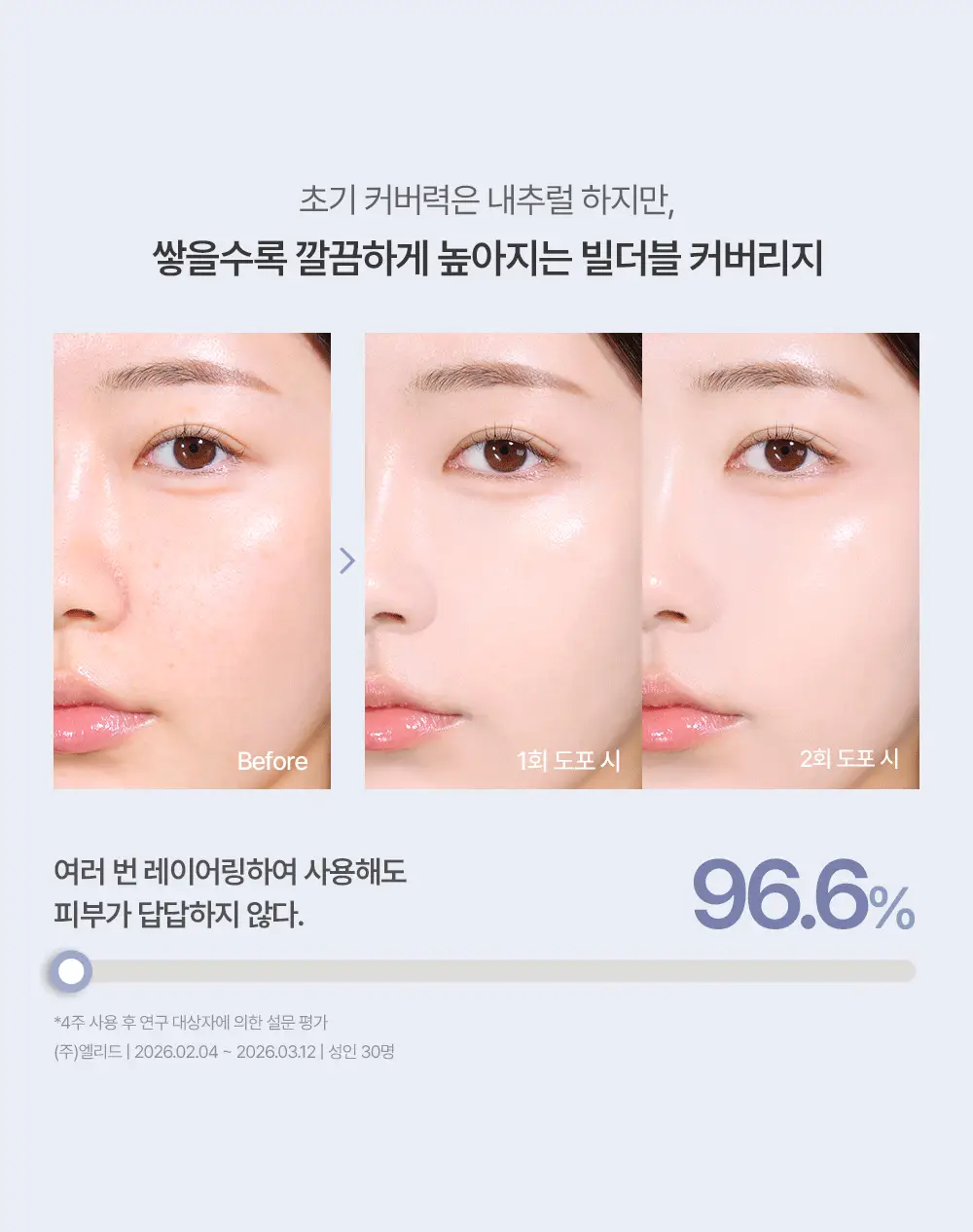 [에스트라 공동개발/5월 올영픽] 에스쁘아 더마커버 블레미쉬 밤 40g 2colors (+에스트라 클렌징폼) 상세페이지 30